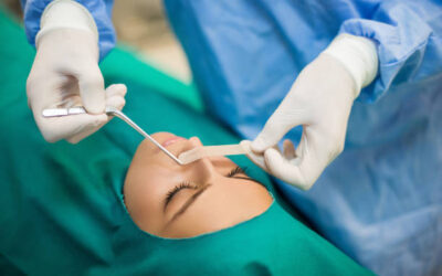 Combien de temps faut-il pour dégonfler complètement après une rhinoplastie à Lyon ?