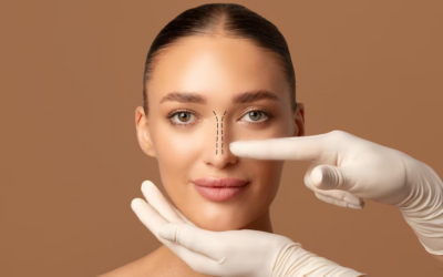 Quelle est la différence entre une rhinoplastie esthétique et une chirurgie de la cloison nasale à Lyon ?