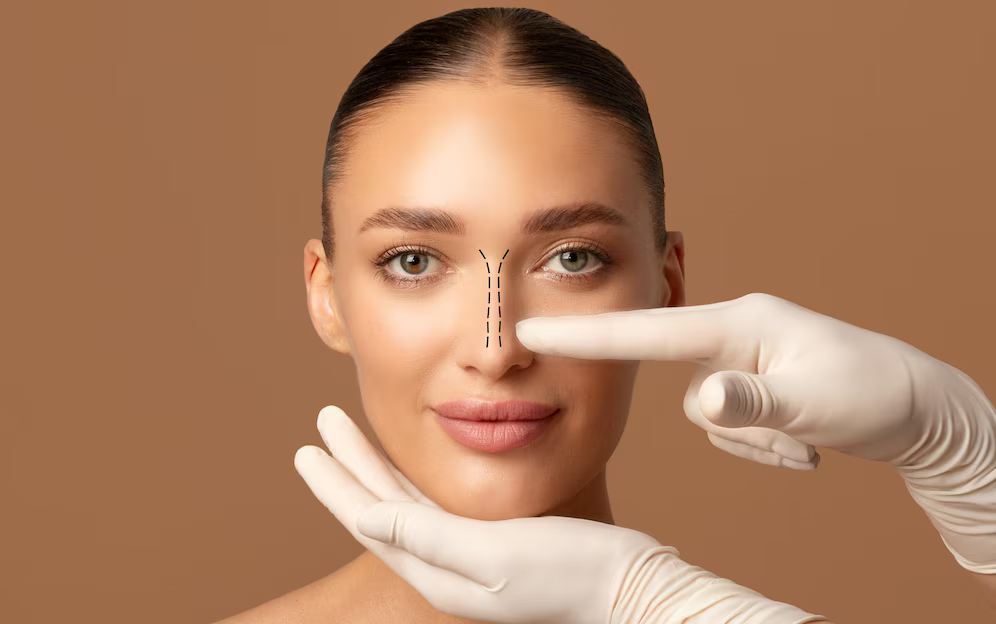 chirurgie de la cloison nasale