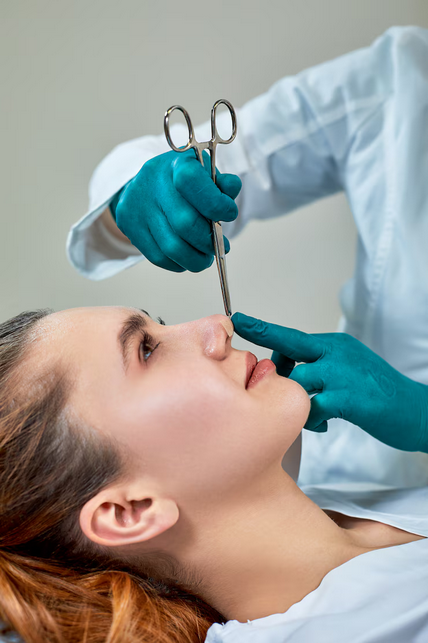 Rhinoplastie à Lyon : que faire si le résultat final ne correspond pas aux attentes ?