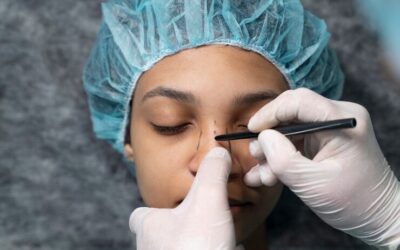 Les résultats d’une rhinoplastie à Lyon sont-ils visibles immédiatement après le retrait de l’attelle ?