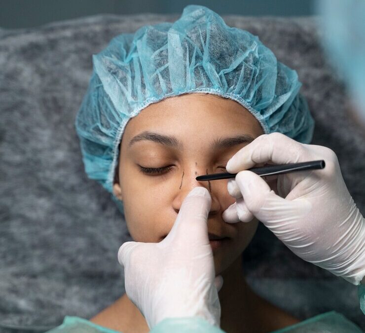 Les résultats d’une rhinoplastie à Lyon sont-ils visibles immédiatement après le retrait de l’attelle ?