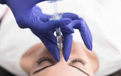 Comment limiter les ecchymoses et gonflements après une rhinoplastie à Lyon ?