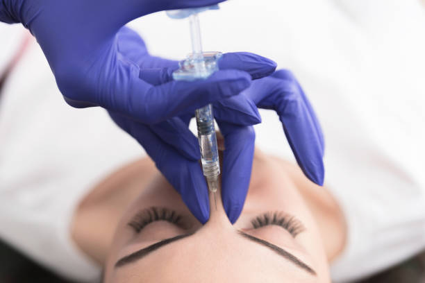 rhinoplastie à Lyon