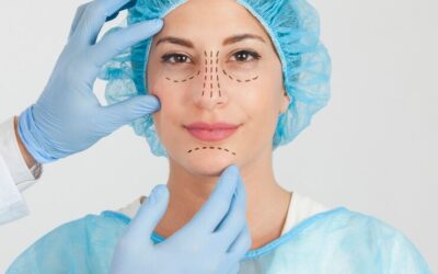 Rhinoplastie à Lyon : faut-il prévoir un accompagnant le jour de l’intervention ?