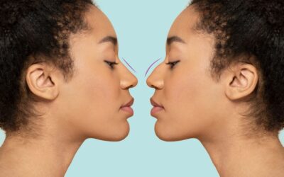 Peut-on faire une rhinoplastie à Lyon si l’on prend un traitement médical au long cours ?