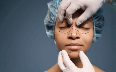 Quels sont les risques et effets secondaires possibles d’une chirurgie nasale à Lyon ?