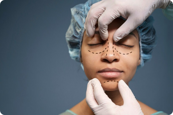 chirurgie nasale à Lyon