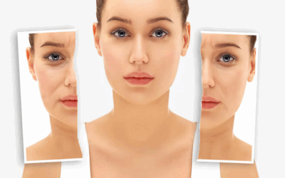 Rhinoplastie avant et après à Lyon : quelles différences entre les interventions esthétiques et fonctionnelles ?