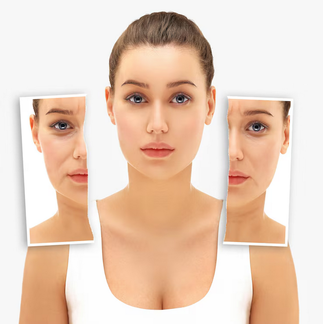 rhinoplastie avant et après à Lyon