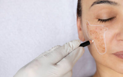 Quelle est la différence entre la chirurgie cutanée et réparatrice du visage et la chirurgie esthétique simple à Lyon ?