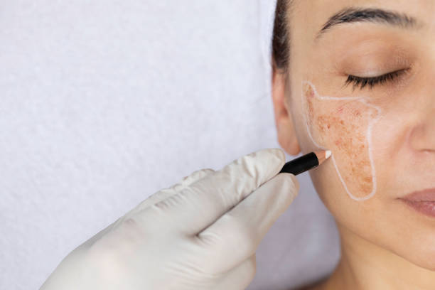 Quelle est la différence entre la chirurgie cutanée et réparatrice du visage et la chirurgie esthétique simple à Lyon ?