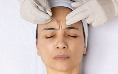 Quels types de cicatrices peuvent être traités par une chirurgie cutanée et réparatrice du visage à Lyon ?