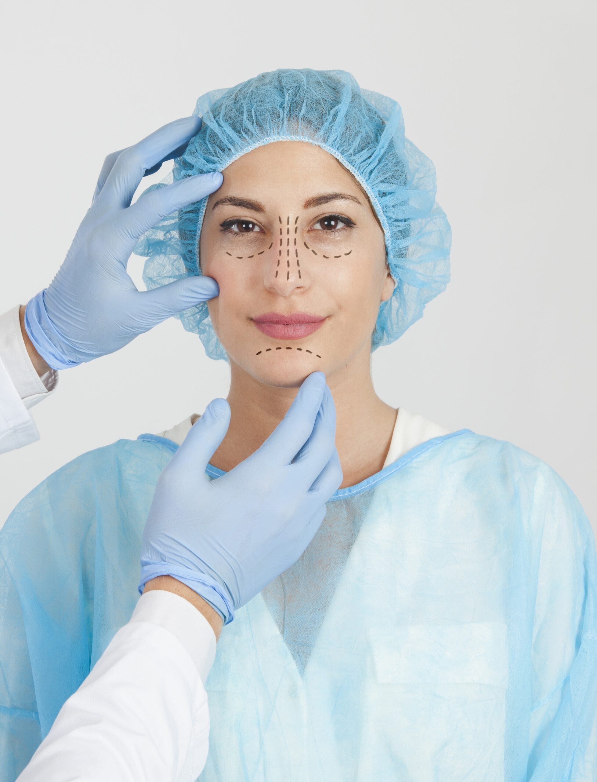 Rhinoplastie à Lyon