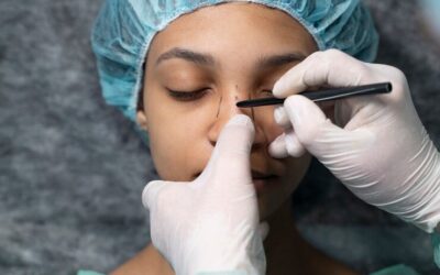 Quelles précautions prendre pour dormir après une rhinoplastie à Lyon ?