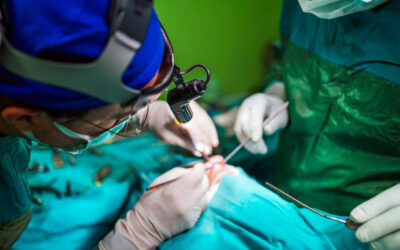 Rhinoplastie à Lyon : Est-il possible de modifier uniquement l’arête nasale ?