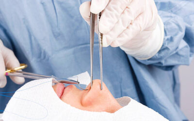Peut-on corriger un nez large avec une rhinoplastie à Lyon ?