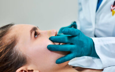 Quels sont les signes à surveiller lors de la période de récupération après une rhinoplastie à Lyon ?