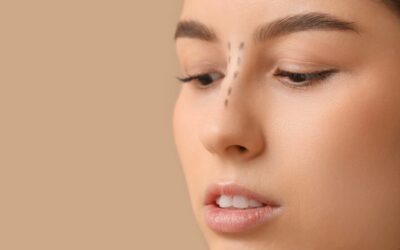 Rhinoplastie ultrasonique : technique, prix, avantages